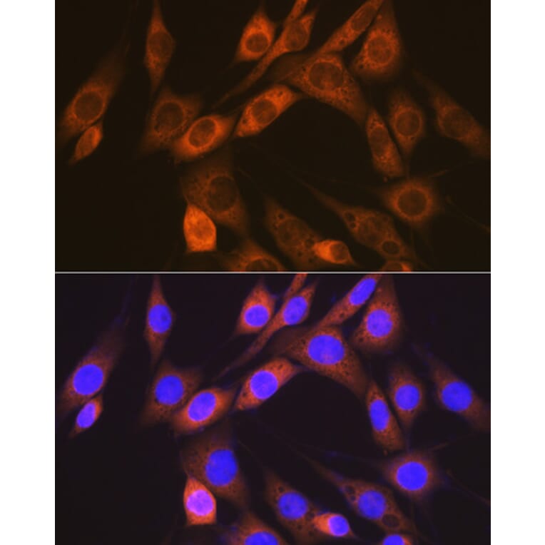 Immunofluorescence - Anti-ALK-1 Antibody [ARC1735] (A309084) - Antibodies.com