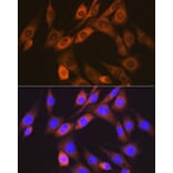 Immunofluorescence - Anti-ALK-1 Antibody [ARC1735] (A309084) - Antibodies.com