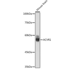Western Blot - Anti-Activin Receptor Type IA Antibody [ARC2449] (A309085) - Antibodies.com