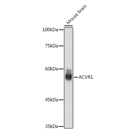 Western Blot - Anti-Activin Receptor Type IA Antibody [ARC2449] (A309085) - Antibodies.com