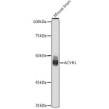 Western Blot - Anti-Activin Receptor Type IA Antibody [ARC2449] (A309085) - Antibodies.com