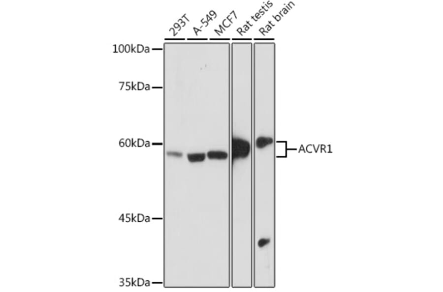 Western Blot - Anti-Activin Receptor Type IA Antibody [ARC2449] (A309085) - Antibodies.com