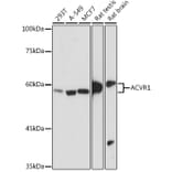 Western Blot - Anti-Activin Receptor Type IA Antibody [ARC2449] (A309085) - Antibodies.com