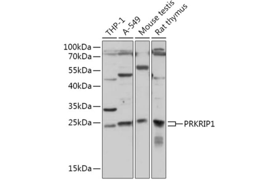 Western Blot - Anti-PRKRIP1 Antibody (A309086) - Antibodies.com