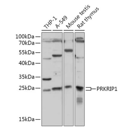 Western Blot - Anti-PRKRIP1 Antibody (A309086) - Antibodies.com