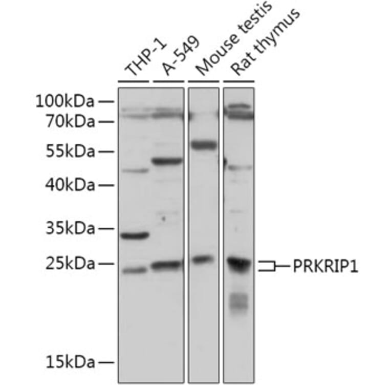 Western Blot - Anti-PRKRIP1 Antibody (A309086) - Antibodies.com