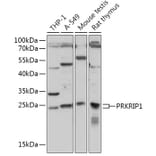 Western Blot - Anti-PRKRIP1 Antibody (A309086) - Antibodies.com