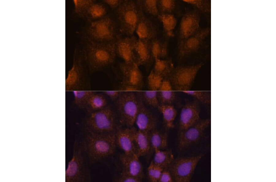 Immunofluorescence - Anti-PRKRIP1 Antibody (A309086) - Antibodies.com
