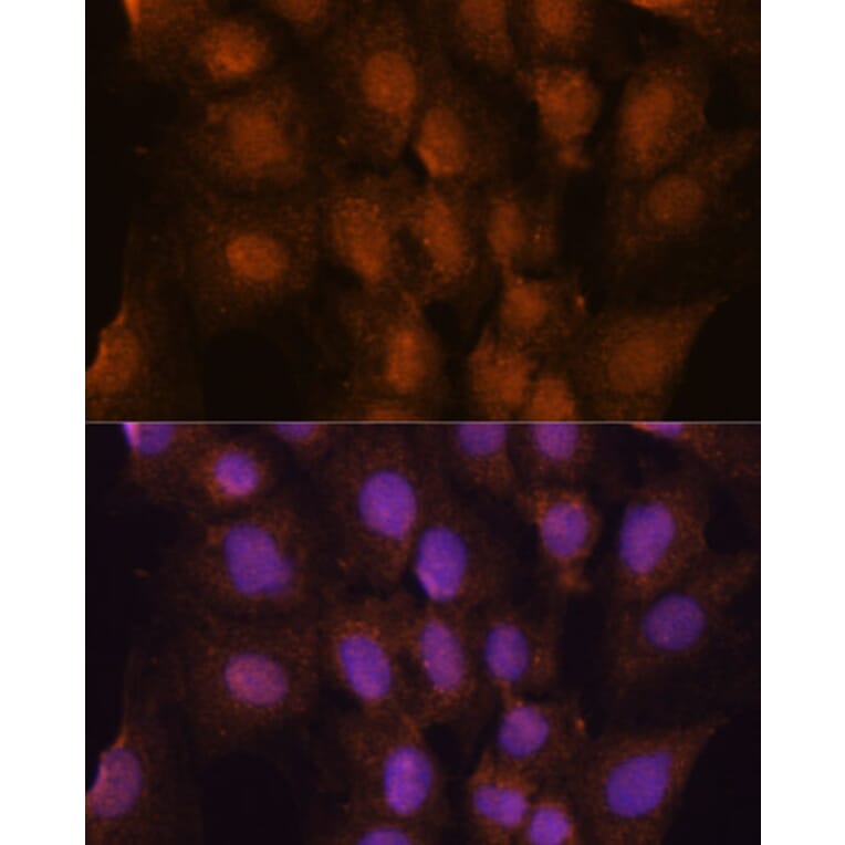 Immunofluorescence - Anti-PRKRIP1 Antibody (A309086) - Antibodies.com