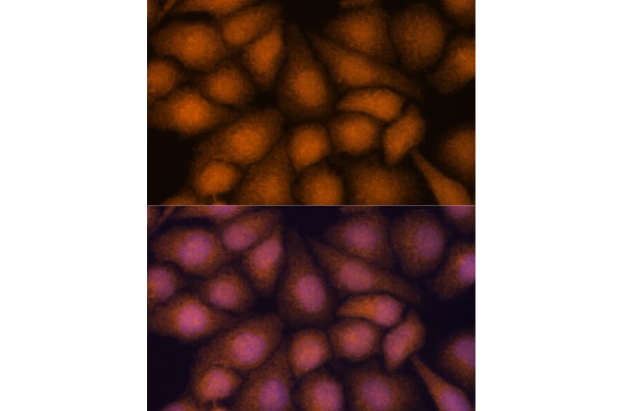 Immunofluorescence - Anti-PRKRIP1 Antibody (A309086) - Antibodies.com