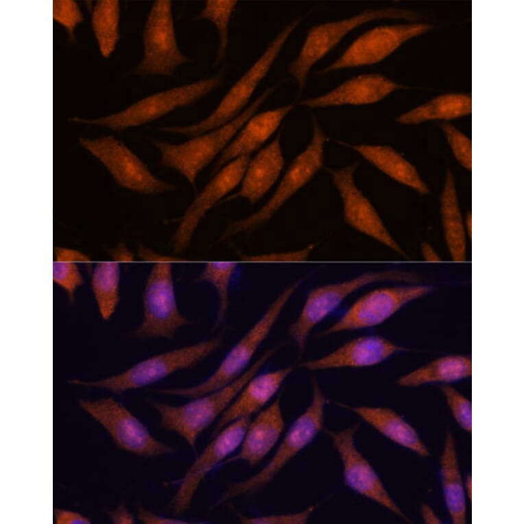 Immunofluorescence - Anti-PRKRIP1 Antibody (A309086) - Antibodies.com