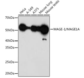 Western Blot - Anti-MAGEA1 Antibody [ARC1839] (A309087) - Antibodies.com