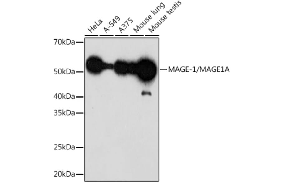 Western Blot - Anti-MAGEA1 Antibody [ARC1839] (A309087) - Antibodies.com