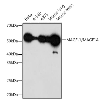 Western Blot - Anti-MAGEA1 Antibody [ARC1839] (A309087) - Antibodies.com
