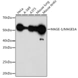 Western Blot - Anti-MAGEA1 Antibody [ARC1839] (A309087) - Antibodies.com