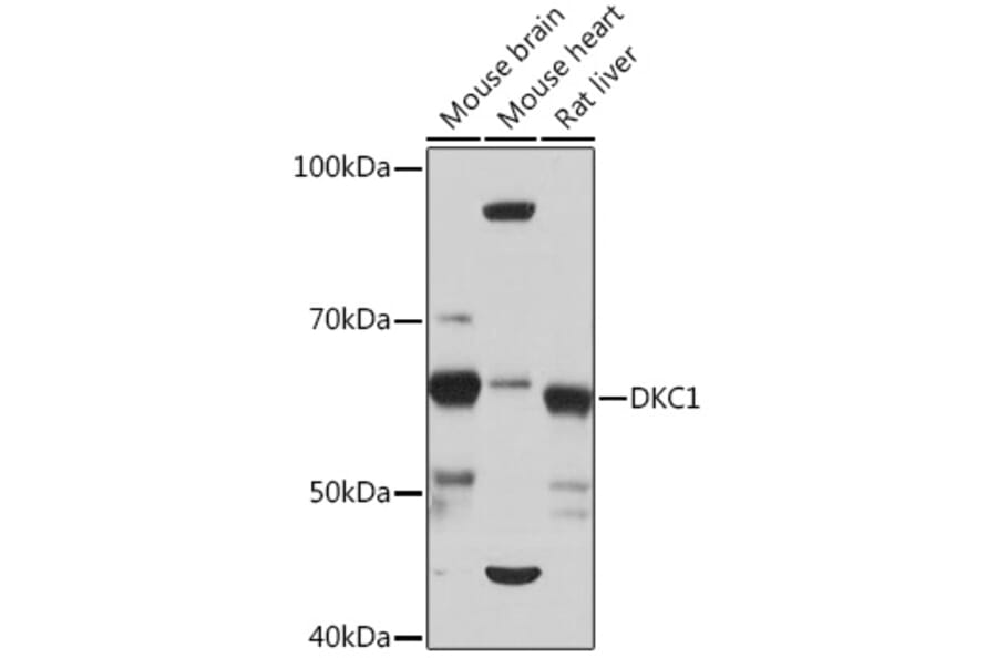 Western Blot - Anti-DKC1/Dyskerin Antibody [ARC1063] (A309088) - Antibodies.com