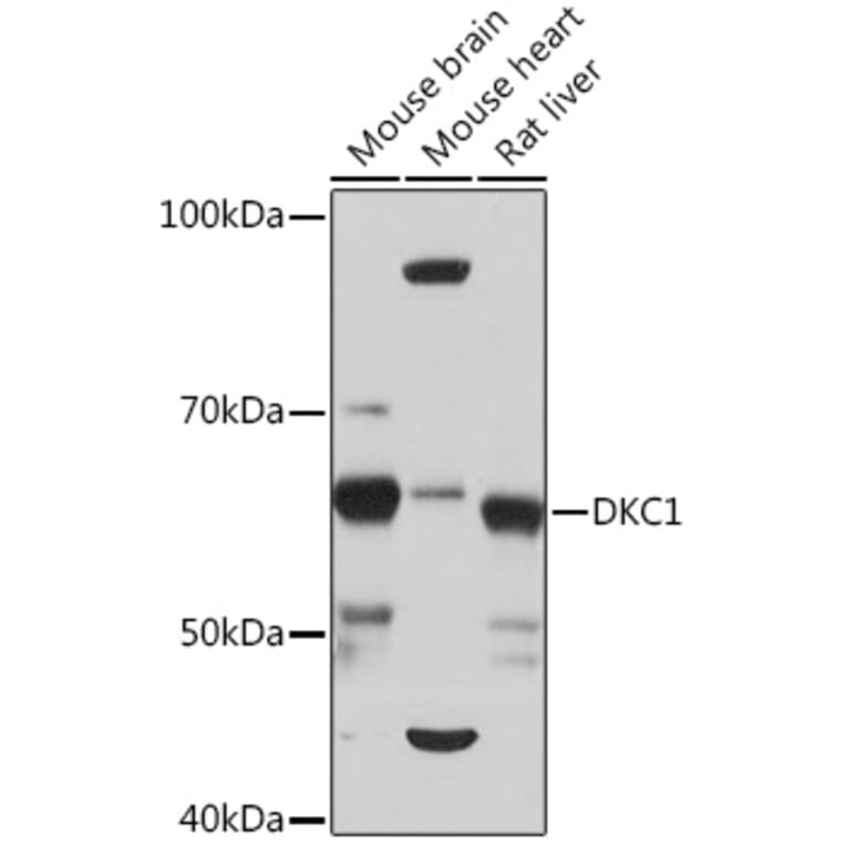 Western Blot - Anti-DKC1/Dyskerin Antibody [ARC1063] (A309088) - Antibodies.com