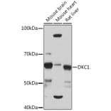 Western Blot - Anti-DKC1/Dyskerin Antibody [ARC1063] (A309088) - Antibodies.com