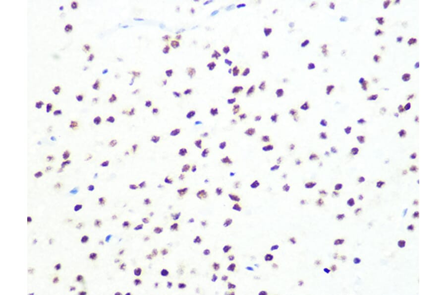 Immunohistochemistry - Anti-DKC1/Dyskerin Antibody [ARC1063] (A309088) - Antibodies.com