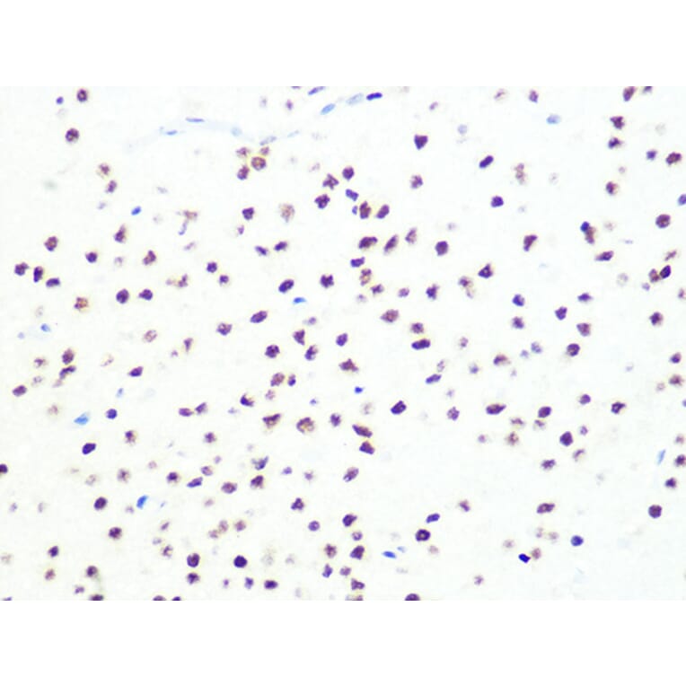 Immunohistochemistry - Anti-DKC1/Dyskerin Antibody [ARC1063] (A309088) - Antibodies.com