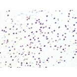 Immunohistochemistry - Anti-DKC1/Dyskerin Antibody [ARC1063] (A309088) - Antibodies.com