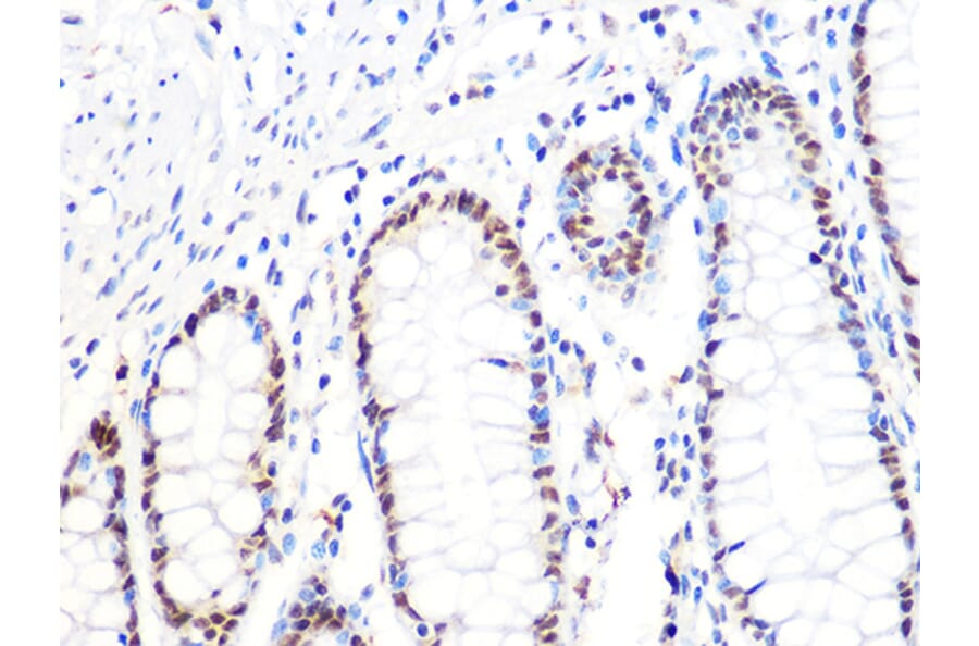 Immunohistochemistry - Anti-DKC1/Dyskerin Antibody [ARC1063] (A309088) - Antibodies.com