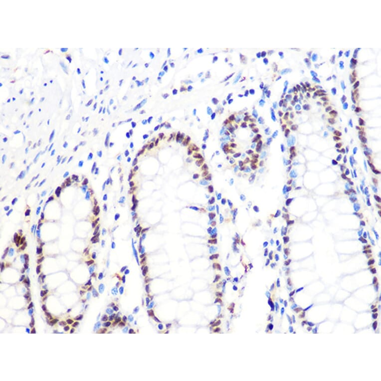 Immunohistochemistry - Anti-DKC1/Dyskerin Antibody [ARC1063] (A309088) - Antibodies.com