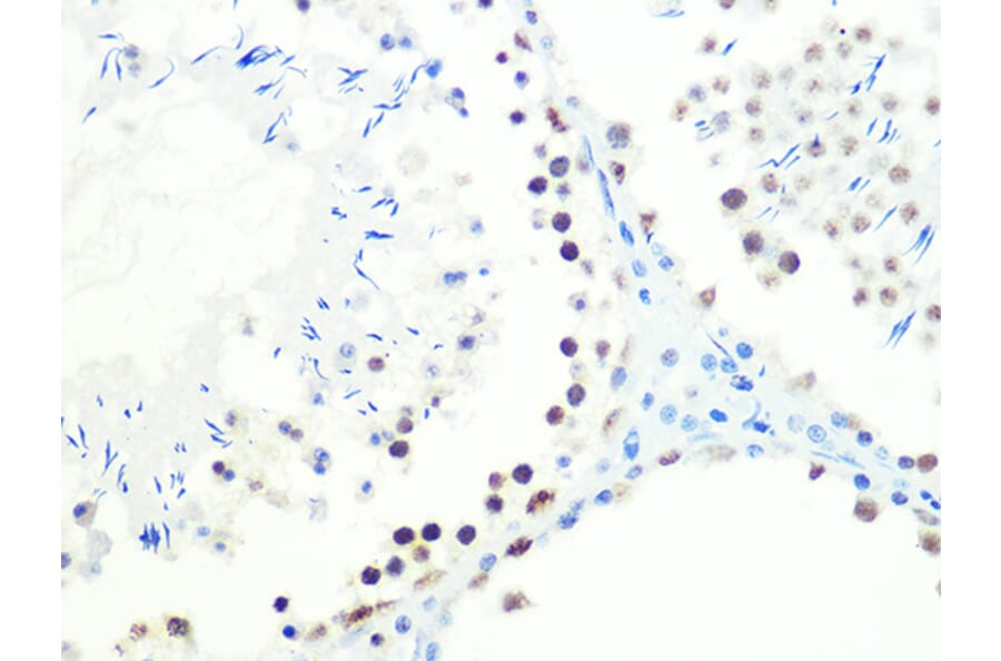Immunohistochemistry - Anti-DKC1/Dyskerin Antibody [ARC1063] (A309088) - Antibodies.com