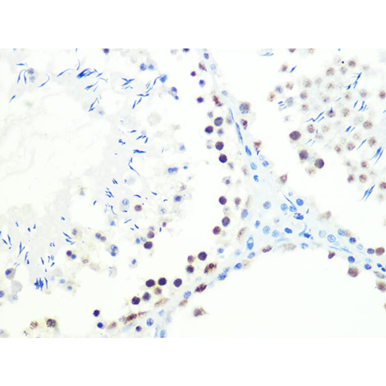 Immunohistochemistry - Anti-DKC1/Dyskerin Antibody [ARC1063] (A309088) - Antibodies.com