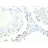 Immunohistochemistry - Anti-DKC1/Dyskerin Antibody [ARC1063] (A309088) - Antibodies.com