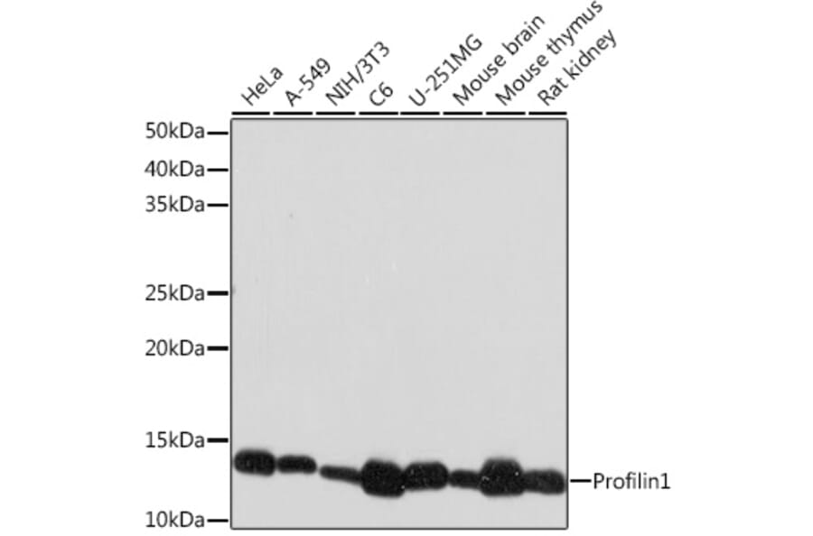 Western Blot - Anti-Profilin 1 Antibody [ARC1469] (A309090) - Antibodies.com