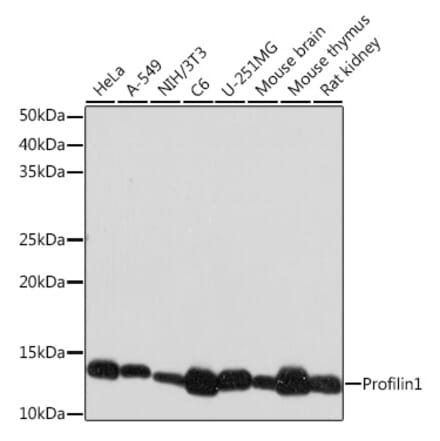 Western Blot - Anti-Profilin 1 Antibody [ARC1469] (A309090) - Antibodies.com