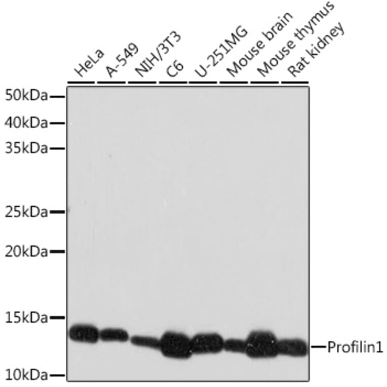 Western Blot - Anti-Profilin 1 Antibody [ARC1469] (A309090) - Antibodies.com