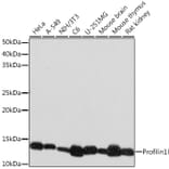 Western Blot - Anti-Profilin 1 Antibody [ARC1469] (A309090) - Antibodies.com