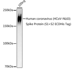 Western Blot - Anti-Human Coronavirus Spike glycoprotein Antibody (A309091) - Antibodies.com