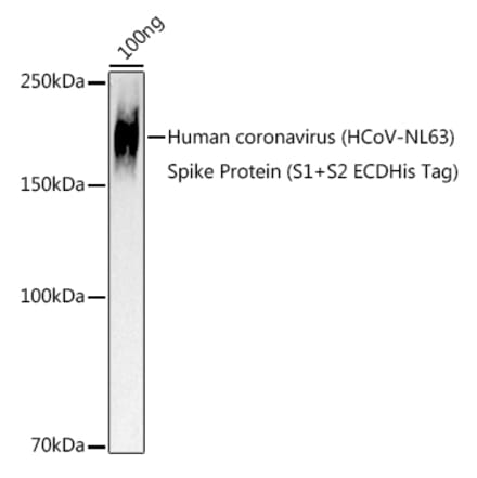 Western Blot - Anti-Human Coronavirus Spike glycoprotein Antibody (A309091) - Antibodies.com