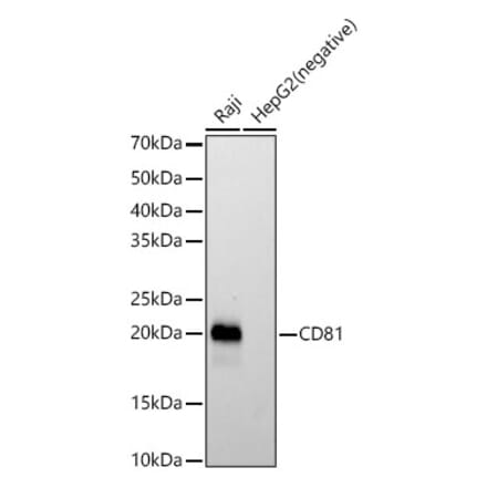 Western Blot - Anti-CD81 Antibody [ARC57928] (A309092) - Antibodies.com