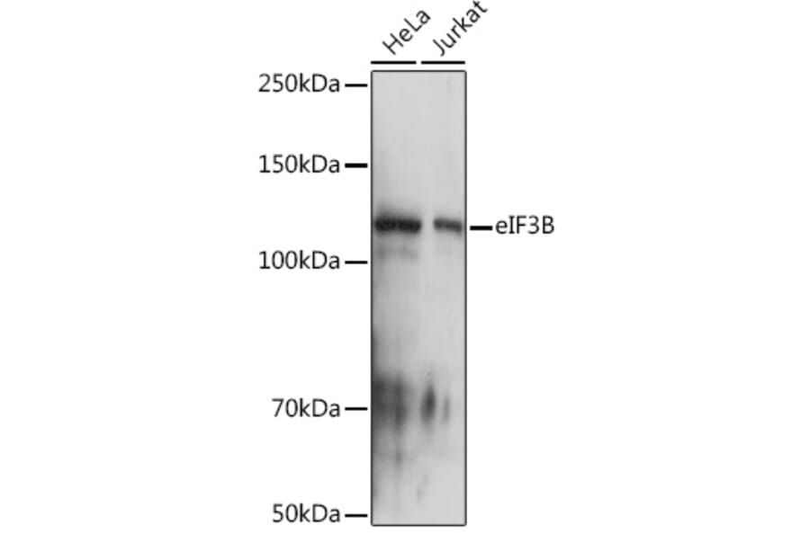 Western Blot - Anti-eIF3B Antibody [ARC1448] (A309096) - Antibodies.com