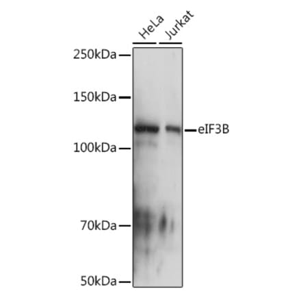 Western Blot - Anti-eIF3B Antibody [ARC1448] (A309096) - Antibodies.com