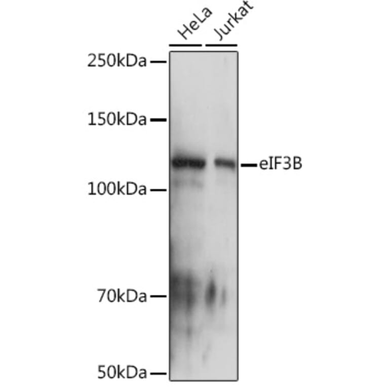 Western Blot - Anti-eIF3B Antibody [ARC1448] (A309096) - Antibodies.com