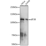 Western Blot - Anti-eIF3B Antibody [ARC1448] (A309096) - Antibodies.com