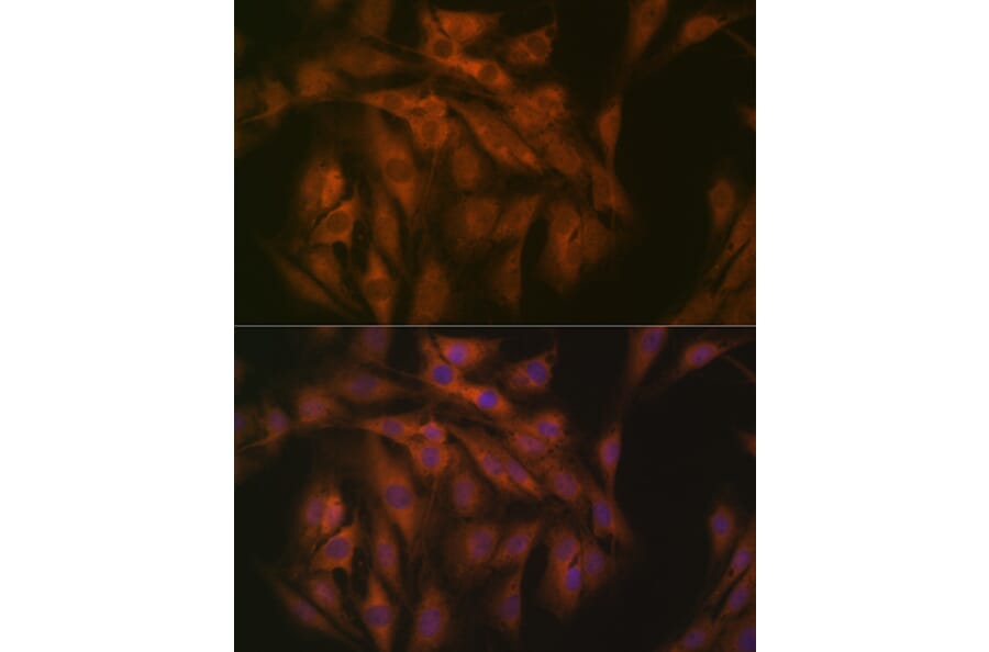 Immunofluorescence - Anti-eIF3B Antibody [ARC1448] (A309096) - Antibodies.com