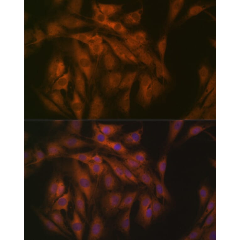 Immunofluorescence - Anti-eIF3B Antibody [ARC1448] (A309096) - Antibodies.com