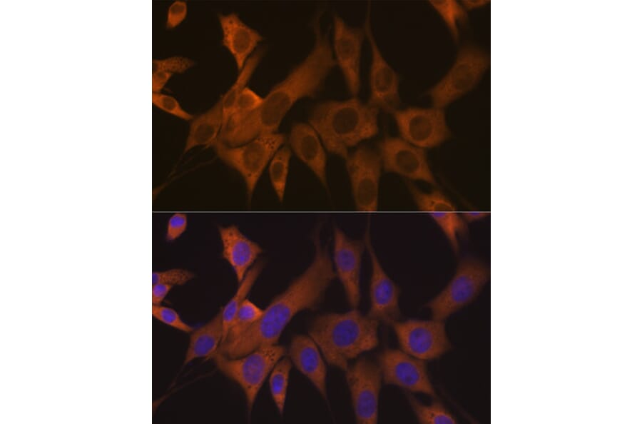Immunofluorescence - Anti-eIF3B Antibody [ARC1448] (A309096) - Antibodies.com