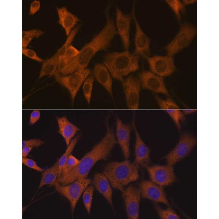 Immunofluorescence - Anti-eIF3B Antibody [ARC1448] (A309096) - Antibodies.com