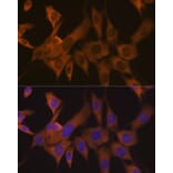 Immunofluorescence - Anti-eIF3B Antibody [ARC1448] (A309096) - Antibodies.com