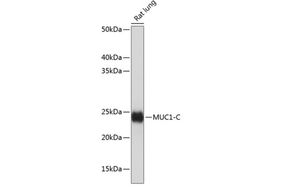 Western Blot - Anti-MUC1 Antibody [ARC0352] (A309097) - Antibodies.com