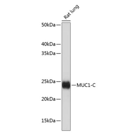 Western Blot - Anti-MUC1 Antibody [ARC0352] (A309097) - Antibodies.com