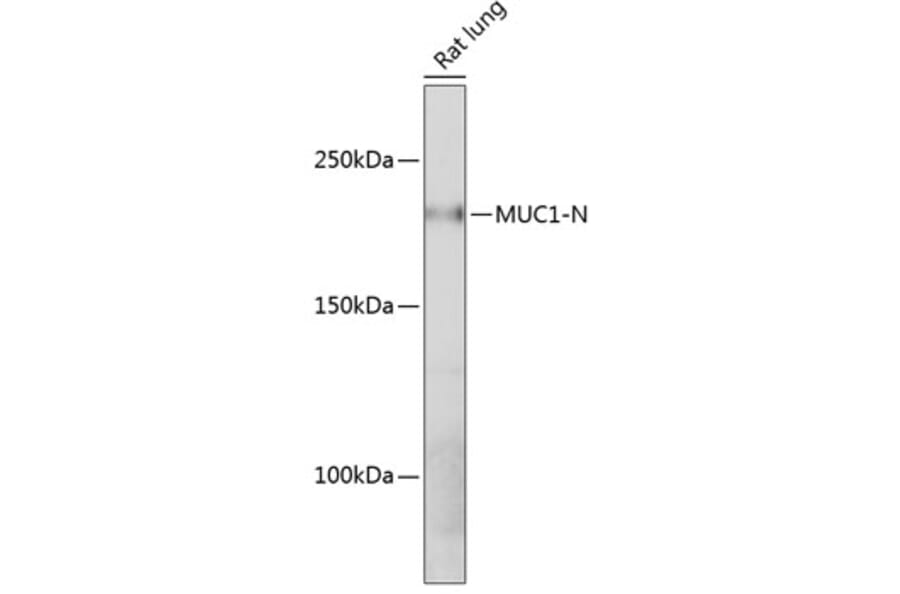 Western Blot - Anti-MUC1 Antibody [ARC0352] (A309097) - Antibodies.com
