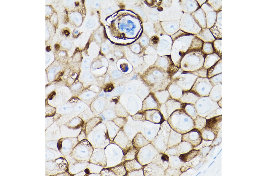 Immunohistochemistry - Anti-MUC1 Antibody [ARC0352] (A309097) - Antibodies.com